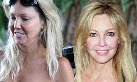 heather locklear|what happened to heather locklear's face.